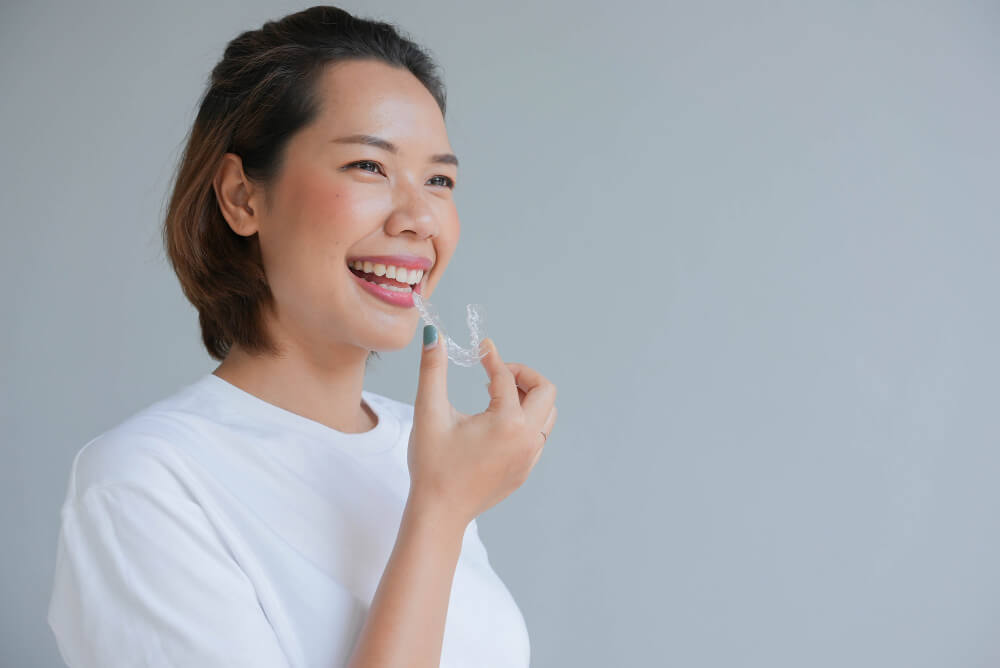 apakah-bisa-mengganti-invisalign-setiap-minggu