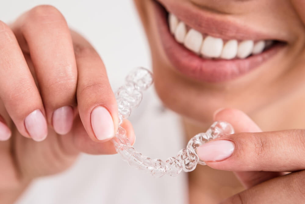 invisalign-untuk-gigi-underbite