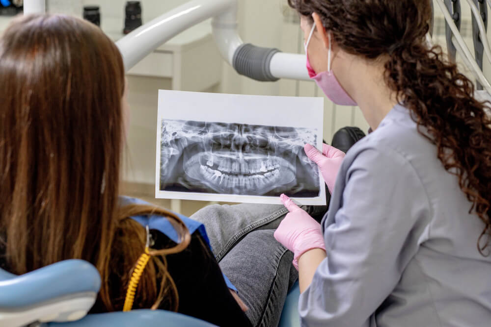 invisalign-vs-damon
