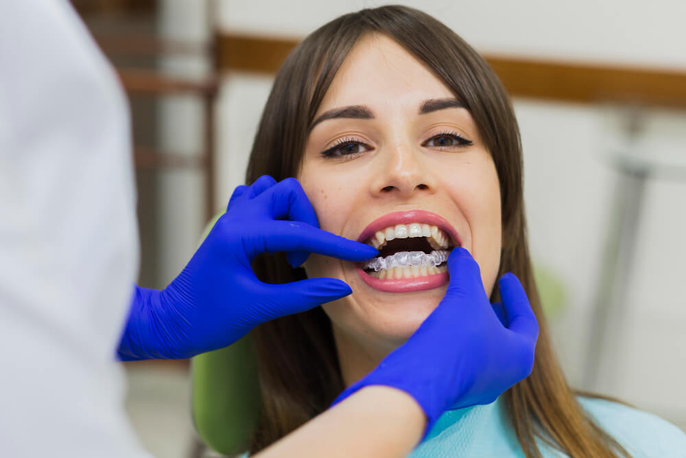 invisalign-untuk-rahang-sempit