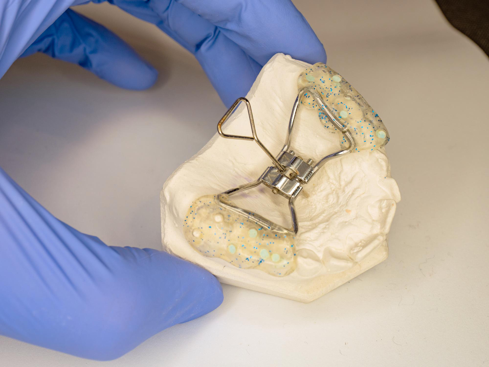 palatal-expander-dan-konvensional